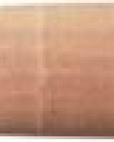 watch-image